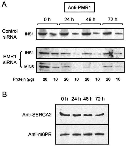 FIG. 3. Silencing of endogenous PMR1 using siRNA. A: INS1 or MIN6 whole-cell lysates were prepared 0, 24, 48, and 72 h after transfection with control scrambled siRNA or PMR1 siRNA (as indicated). For each lane, 20 μg protein (or 10 μg where indicated) of siRNA-treated cell lysates were probed with rabbit anti-PMR1 (1:1,000) or, in B, with goat anti-SERCA2 (1:500; Santa Cruz) or rabbit anti-m6PR (1:1,000; Affinity BioReagents). Immunoreactivity was visualized with anti-rabbit IgG HRP (1:80,000; Sigma) or anti-goat HRP (1:10,000; Sigma). Each image is representative of three separate experiments for each cell type.