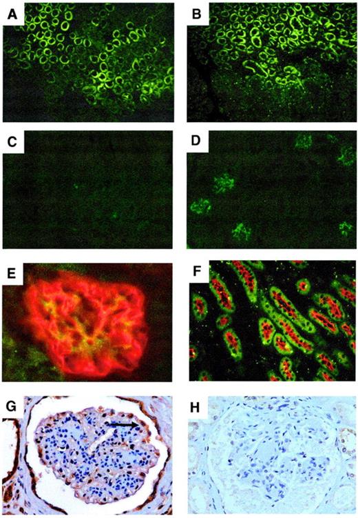 FIG. 7. Immunohistochemical localization of OPN in mouse control and diabetic kidneys. Normal (24-week-old db/m) (A, C, and F) and diabetic (24-week-old db/db) (B, D, and E) mouse kidney sections were stained with anti-OPN antibody and visualized with fluorescein-labeled goat anti-mouse secondary antibody (green). Sections E and F were costained with rabbit anti-synaptopodin and rabbit anti-Na/K/2Cl, respectively, and were developed with Cy3 goat anti-rabbit secondary antibody (red). The expression was increased in podocytes in diabetic samples (D) compared with the control tissue (C). Similar to murine samples, podocyte express OPN in human diabetic kidney samples (G), which can be blocked with neutralizing peptide (H). The arrow shows positive DPN staining in podocytes.
