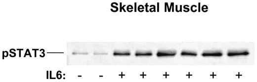 FIG. 3. Tyrosine phosphorylation of STAT3 in skeletal muscle (gastrocnemius) of saline or IL-6–treated mice.