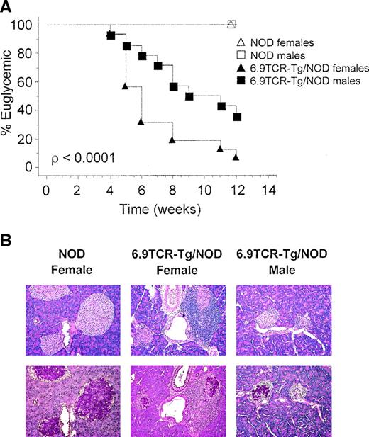 FIG. 3. Diabetes is severe and accelerated in 6.9TCR/NOD mice. A: The onset of diabetes was accelerated in 6.9TCR/NOD at backcross 4–5 (n = 15 females and 14 males) compared with sex-matched nontransgenic NOD (n = 6 females and 14 males) littermates. Urine glucose levels were monitored daily for the first 4 weeks of life and three times per week thereafter. Diabetes was confirmed in mice with glucosuria by measuring blood glucose levels. Mice were considered overtly diabetic when urine glucose was >2% and blood glucose was >15 mmol/l. The percentage of euglycemic mice is plotted on Kaplan-Meier curves, with statistical analysis performed using the Mantel-Cox log-rank test. B: Representative photomicrographs (original magnification, ×20) of hematoxylin and eosin- (top) or aldehyde-fuchsin (bottom)-stained pancreas tissue sections from 3- to 5-week-old 6.9TCR/NOD or age-matched nontransgenic NOD mice. C and D: Increased islet inflammation and degranulation is consistent with an accelerated disease course in 6.9TCR/NOD compared with nontransgenic NOD littermates. Data were compiled from pancreas sections taken from 3- to 5-week-old 6.9TCR/NOD mice and age-matched nontransgenic littermates (6–9 mice/group) as described in research design and methods. C: , no infiltrate; □, polar infiltrate; , peri-islet infiltrate; ▪, intraislet infiltrate. D: , fully granulated; □, 50–75% granulated; , 20–50% granulated; ▪, fully degranulated.