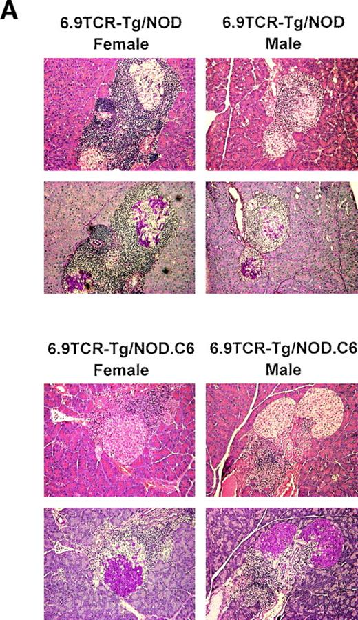 FIG. 6. Mild islet infiltration is evident in 6.9TCR/NOD.C6 mice. A: Representative photomicrographs (original magnification, ×20) of hematoxylin and eosin (top)- or aldehyde-fuchsin (bottom)-stained pancreatic tissue sections from 8- to 13-week-old 6.9TCR/NOD mice or age-matched 6.9TCR/NOD.C6 mice. B: The extent of islet inflammation in 6.9TCR/NOD.C6 mice was low compared with that of 6.9TCR Tg/NOD mice. Data are compiled from pancreas sections taken from 8- to 13-week-old 6.9TCR/NOD and age-matched 6.9TCR/NOD.C6 mice (3–9 mice/group) as described in research design and methods. , no infiltrate; □, polar infiltrate, , peri-islet infiltrate, ▪, intra-islet infiltrate.