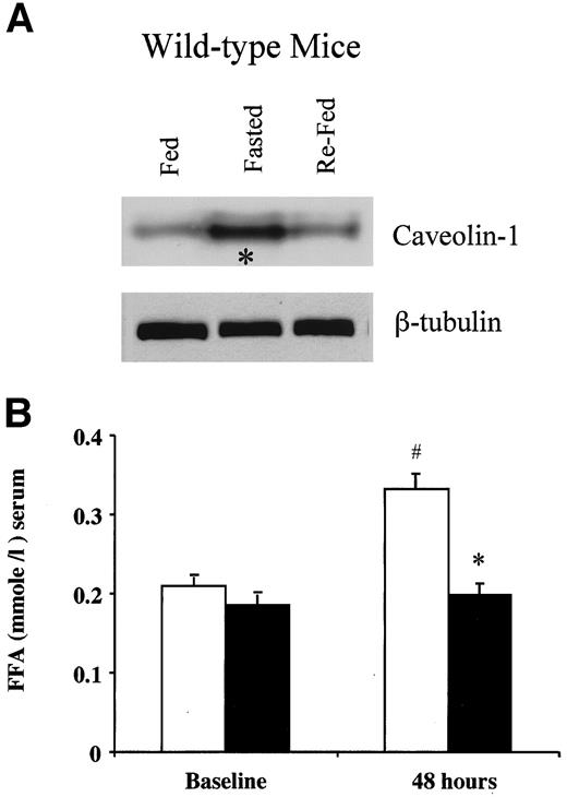 FIG. 1. Caveolin-1 null mice show an impaired physiological response to fasting. A: Fasting increases the expression of caveolin-1 in the perigonadal fat pads of wild-type mice, as seen by Western blot analysis. B: Serum NEFA levels. The NEFA levels rise significantly in wild-type, but not caveolin-1 knockout, mice after a 48-h fast. Values represent the means ± SEM. FFA, free fatty acid. *P < 0.05 for caveolin-1 knockout vs. wild type; #P < 0.05 for wild type 48 h vs. 0 h. □, wild type; ▪, caveolin-1 knockout.