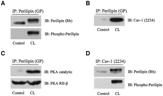 FIG. 4. β3-Agonist stimulation (CL-316,243) of 3T3-L1 adipocytes induces the formation of a tight complex containing caveolin-1 (Cav-1), PKA, and perilipin. A: Perilipin phosphorylation. Western blot analysis of perilipin immunoprecipitants demonstrates that CL-316,243 causes a dramatic increase in perilipin phosphorylation. B: Perilipin/caveolin-1 interactions. Note that CL-316,243 stimulation results in a tight association between perilipin and caveolin-1. C: Perilipin/PKA interactions. Note that the catalytic subunit of PKA also coimmunoprecipitates with perilipin after CL-316,243 stimulation, whereas the PKA type II-β regulatory subunit is constitutively associated with perilipin. D: Caveolin-1/perilipin interactions. Immunoprecipitation with anti-caveolin-1 demonstrates that CL-316,243 stimulation leads to complex formation between phosphorylated perilipin and caveolin-1. CL, CL-316,243. GP, guinea pig polyclonal antibody; IB, immunoblot; IP, immunoprecipitation; Rb, rabbit polyclonal antibody.