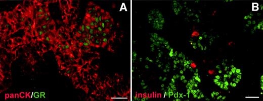 FIG. 1. GR is expressed in E15.5 rat pancreatic bud. A: GR (green) is detected in a subpopulation of epithelial pan-cytokeratin (panCK)-positive cells (red). B: Few cells coexpressing insulin (red) and Pdx-1 (green) are found in E15.5 rat pancreatic buds. Scale bar = 25 μm.