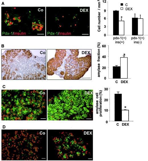 FIG. 2. DEX favors in vitro pancreatic differentiation into exocrine tissue and represses β-cell differentiation. The effect of a 3-day treatment of E15.5 rat pancreatic buds with 10−7 mol/l DEX on differentiation into β-cells or acinar cells is shown. A: Clusters of cells coexpressing insulin (red) and Pdx-1 (green) are abundant in control buds (Co, C), but not in DEX-treated buds (DEX). Scale bar = 25 μm. The number of differentiated β-cells coexpressing Pdx-1 and insulin was decreased upon DEX treatment, whereas the number of precursor cells expressing only Pdx-1 remained unchanged. B: Amylase cell area (brown) was increased twofold in DEX-treated buds. Scale bar = 50 μm. C: BrdU+ nuclei (red) were counted in amylase immunoreactive cells (green): acinar cell proliferation was decreased in DEX-treated E15.5 embryonic pancreas after 3 days. D: After 1 day of DEX treatment, acinar cell proliferation was similar to that in untreated buds (Co), but amylase-expressing cell numbers were already increased. Scale bar = 50 μm. Results are expressed as means ± SE; *P < 0.05 compared with the untreated group.