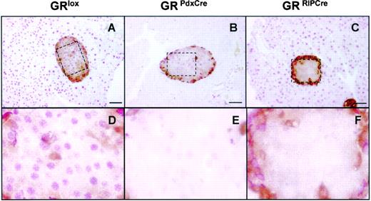 FIG. 4. Assessment of the GR deletion in control GRlox/lox, GRPdx-Cre, and GRRIP-Cre adult mice. Double immunohistochemistry was performed on pancreatic sections for GR (pink) and glucagon (brown). In control mice, the GR was normally expressed in exocrine and endocrine cells (A). In GRPdx-Cre mice, the GR was deleted in all exocrine cells and most of the β-cells (B). In GRRIP-Cre mice, the GR was specifically deleted in all the differentiated β-cells (C) but present in other pancreatic cells. D, E, and F are higher magnification of the boxed area shown in A, B, and C, respectively. Scale bar = 50 μm.