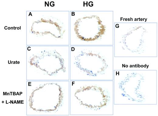 FIG. 5. Nitrotyrosine (NT) levels in RSCAs. The findings are representative of five different preparations. A and B: Arteries were incubated for 24 h in NG or HG. Brown staining indicates NT residues. Staining was more prominent in HG. C and D: Immunoreactivity was reduced by 100 μmol/l urate, a scavenger of ONOO−. E and F: Immunoreactivity also was reduced by 300 μmol/l MnTBAP and 100 μmol/l l-NAME. G: A freshly isolated artery was used as a control. H: Immunoreactivity was lost in the absence of anti-NT.