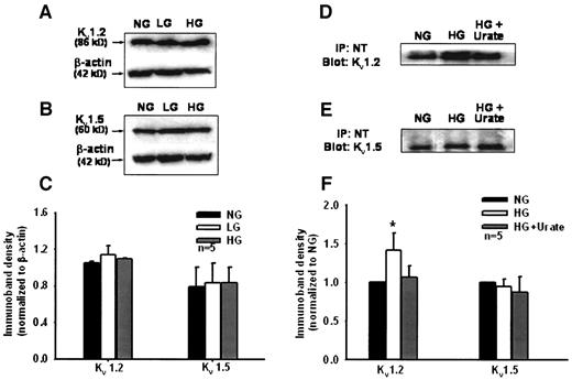 FIG. 6. A and B: Western blots demonstrate similar expression of Kv1.2 and Kv1.5 α-subunits, respectively, in RSCAs that were incubated for 24 h in NG, LG, or HG. β-Actin was used as an internal standard. C: Averaged values for five Western blots. D: Immunoprecipitates of Kv1.2 showed elevated NT residues in HG compared with NG arteries. Scavenging of ONOO− by 100 μmol/l urate reduced nitration levels in HG vessels. E: Similar levels of NT residues were detected in Kv1.5 immunoprecipitates from LG and HG arteries. Urate did not alter the immunoreactive signal. F: Average band densities normalized to the NG signal (n = 5). *P < 0.05 vs. NG.