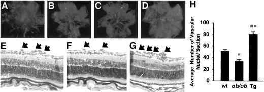 FIG. 1. Retinal vascular pattern by fluorescein-perfused retinal flat mount of wild-type mice (A and B), ob/ob mice (C), and transgenic mice overexpressing leptin (D) with (B–D) or without (A) oxygen treatment. Five days after oxygen treatment (P17), fluorescence perfusion showed that the vasculature is substantially increased in transgenic mice and reduced in ob/ob mice compared with wild-type mice. Cross-sectional analysis of retina from wild-type mice (E), ob/ob mice (F), and transgenic mice (G). Arrows indicate neovascular tufts. Periodic-acid Schiff stain, ×400. H: Quantitative analysis of retinal neovascularization by counting the neovascular cell nuclei. *P < 0.05, **P < 0.01 vs. wild-type mice; n = 9–10. Tg, transgenic mice; wt, wild-type mice.