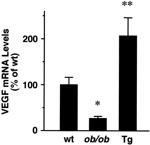 FIG. 3. Gene expression of VEGF in the retina from each strain after oxygen treatment. Real-time quantitative RT-PCR revealed that upregulation of VEGF mRNA was significantly attenuated in ob/ob mice compared with wild-type mice. In contrast, VEGF mRNA levels in leptin transgenic mice were much higher than those in wild-type mice. *P < 0.05, **P < 0.01 vs. wild-type mice; n = 6.