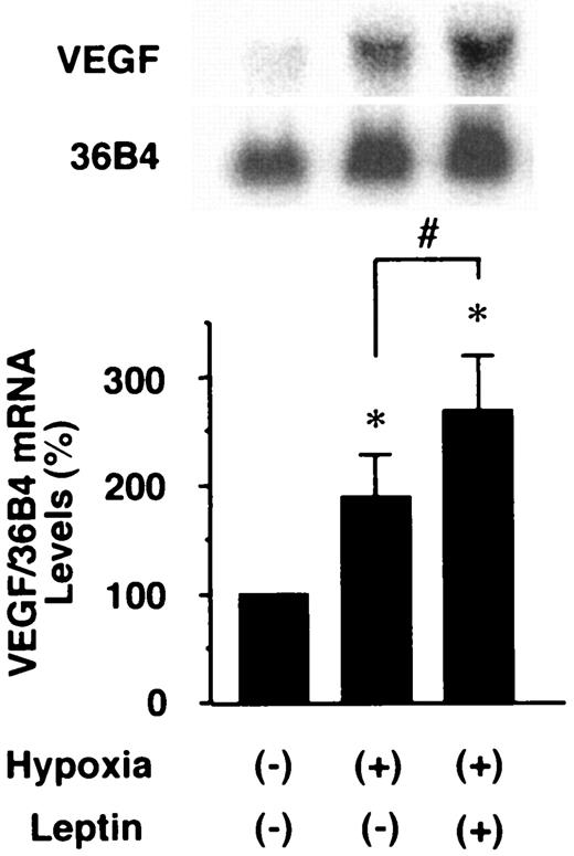 FIG. 5. Effects of leptin on hypoxia-induced VEGF mRNA expression in PRECs. Cells were stimulated with 100 ng/ml leptin or vehicle and incubated with 1% oxygen for 12 h. Leptin significantly enhanced hypoxia-induced VEGF mRNA expression. *P < 0.05 vs. basal level; #P < 0.05; n = 6.