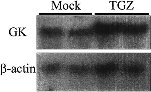 FIG. 1. LGK transcription was increased by troglitazone. Primary hepatocytes were cultured for 48 h in the presence or absence of troglitazone (20 μmol/l) and 9-cis retinoic acid (1 μmol/l). Total RNA (20 μg) was separated on 1% agarose gels and transferred onto a nylon membrane. The membrane was hybridized with 32P-labeled GK and β-actin cDNA probes. The β-actin gene was used as an internal control.