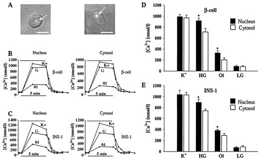 FIG. 1. Nuclear and cytosolic [Ca2+] changes in cultured cells induced by different stimuli. A: Hybrid phase-contrast images of a pancreatic β-cell (left) and an INS-1 cell (right) showing the location of the fluorescence spot focused in the nucleus (bar = 10 μm). B and C: Isolated cells were stimulated with 40 mmol/l K+ (○), 16.7 or 22 mmol/l glucose (G) (•) for β-cells or INS-1 cells, respectively, and 0.5 mmol/l oleate in 3 mmol/l glucose (Ol) (▴) for the time indicated by the line. Ca2+ changes in the nucleoplasm or in the cytoplasm of different pancreatic β-cells (B) and INS-1 cells (C) were monitored by spot confocal microscopy. These records are representative of more than seven cells for each condition from at least three different preparations. D and E: The amplitude of these [Ca2+] changes, measured as the mean [Ca2+] increase during the response, is shown for β-cells (D) and INS-1 cells (E). Data are means ± SE (*P < 0.05, unpaired t test). HG, high glucose (16.7 mmol/l for β-cells and 22 mmol/l for INS-1 cells); LG, low glucose (3 mmol/l). Means were obtained from 7–19 cells for each condition.