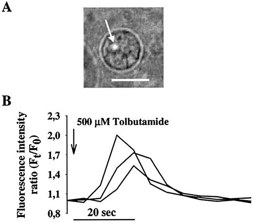 FIG. 2. Nuclear Ca2+ transients induced by blockage of nuclear KATP channels. A: Hybrid phase-contrast image showing the location of the fluorescence spot focused on an isolated nucleus from a β-cell, loaded with the fluorescent probe Calcium Green-1 dextran (bar = 4 μm). B: Closure of nuclear KATP channels with tolbutamide resulted in Ca2+ release from the nuclear envelope to the nucleoplasm. Traces represent three different cases.