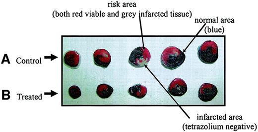 FIG. 1. Representative figure of myocardial infarction. Tetrazolium-stained heart slices taken from control hearts (A) and treated hearts (B) that have been subjected to 35 min of left main coronary artery occlusion followed by 120 min of reperfusion. The slices show areas of infarction (gray), ischemic area or area at risk (red and gray), and nonrisk normal area (blue).