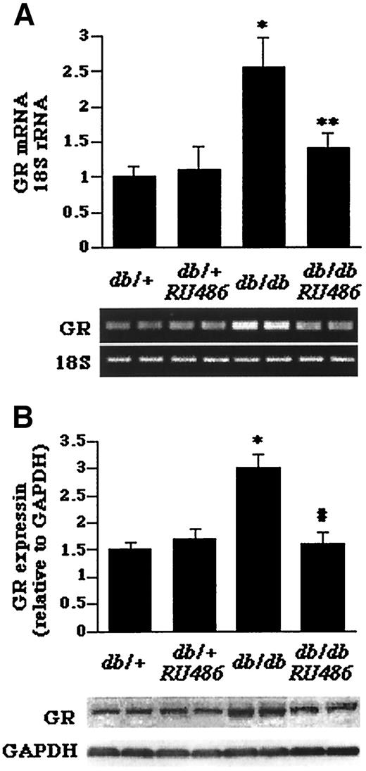 FIG. 2. The expression of glucocorticoid receptor mRNA (A) and protein (B) in the livers of db/+ mice that were treated with vehicle (db/+), db/+ mice that were treated with RU486 (db/+ RU486), db/db mice that were treated with vehicle (db/db), and db/db mice that were treated with RU486 (db/db + RU486) for 3 weeks. A: Expression and relative quantification of glucocorticoid receptor mRNA levels expressed relative to the amount of 18S rRNA. B: Expression and relative quantification of glucocorticoid receptor protein levels expressed relative to the amount of GAPDH. Values are means ± SE; n = 5–6 mice/group. *P < 0.001 vs. db/+ controls; **P < 0.005 vs. db/db mice; #P < 0.01 vs. db/db mice.