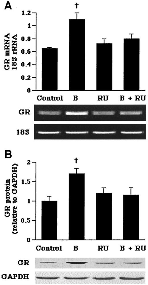FIG. 5. Effects of corticosterone on the expression of glucocorticoid receptor mRNA (A) and protein levels (B) in primary cultures of hepatocytes from db/db mice. A: Expression and relative quantification of glucocorticoid receptor mRNA levels expressed relative to the amount of 18S rRNA. B: Expression and relative quantification of glucocorticoid receptor protein levels expressed relative to the amount of GAPDH. Hepatocytes were incubated in media with indicated concentrations of corticosterone (10−6 mol/l) and RU486 (10−6 mol/l) for 72 h. Values are the means ± SE from three separate culture preparations. †P < 0.01 vs. controls; *P < 0.001 vs. controls.