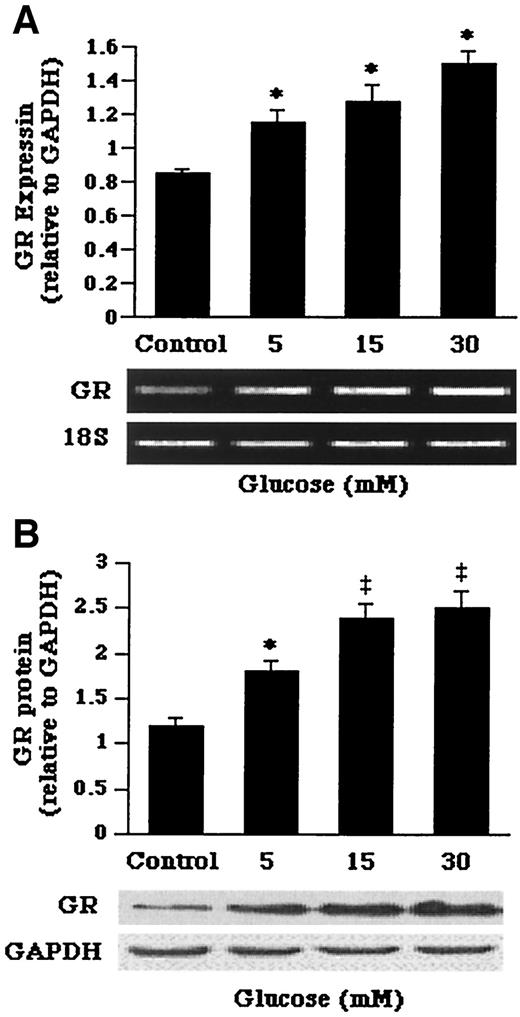FIG. 7. Effects of glucose on the expression of glucocorticoid receptor mRNA (A) and protein levels (B) in primary cultures of hepatocytes from db/db mice. A: Expression and relative quantitation of glucocorticoid receptor mRNA levels expressed relative to the amount of 18S rRNA. B: glucocorticoid receptor protein levels were determined by Western blot analysis and expressed relative to the amount of GAPDH found in controls. Hepatocytes were incubated in glucose-free media with indicated concentrations of glucose (5–30 mmol/l) for 72 h. Values are the means ± SE from three separate culture preparations. *P < 0.01 vs. controls; ‡P < 0.001 vs. controls.