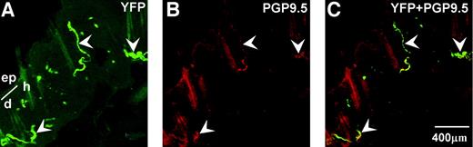 FIG. 2. Photomicrographs showing the YFP cutaneous nerves fibers on 10-μm thick skin sections (green; A) were PGP9.5-immunoreactive (red; B), and the merged images were yellowish (C). The arrowheads indicate the nerve fibers. The boundary between the epidermis and dermis is shown. Note the autofluorescence from the hair shaft. ep, epidermis; d, dermis; h, hair shaft.