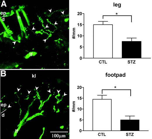 FIG. 5. Photomicrographs showing the cutaneous small YFP fibers in skin biopsy of thy1-YFP mice. Cutaneous small fibers were significantly less in the leg (A) and footpad (B) in 6-months diabetic mice. The arrowheads indicated the nerve fibers. n = 5 for both diabetic and nondiabetic groups. The boundary between epidermis and dermis was shown. ep, epidermis; h, hair shaft; d, dermis; kl, thick keratin layer; lf, large fibers. CTL, control; STZ, streptozotocin-induced diabetic mice. *P < 0.05 by Student’s t test.