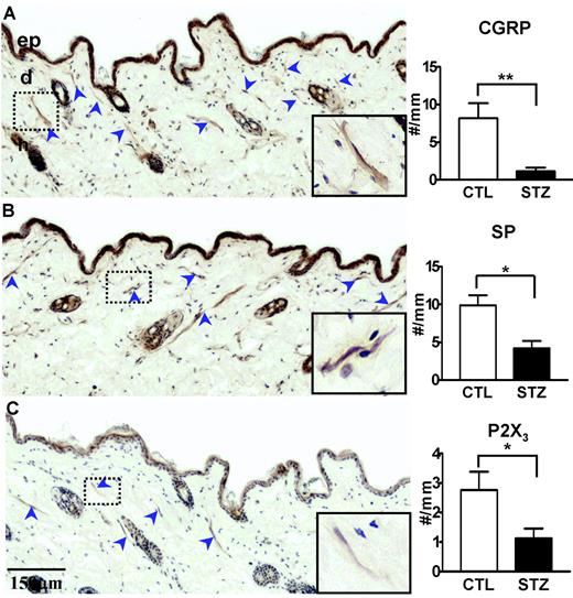 FIG. 6. Photomicrographs showing subpopulation of small nerve fibers in skin biopsy of thy1-YFP mice. CGRP (A), substance P (B), and P2X3 (C) immunoreactive nerve fibers were significantly decreased in the skin of 6-months diabetic mice. The arrowheads indicated the nerve fibers. The insets showed the magnified images of the highlighted nerve fibers. n = 5 for both diabetic and nondiabetic groups. ep, epidermis, d, dermis, h, hair follicle; CTL, control; STZ, streptozotocin-induced diabetic mice. *P < 0.05, ** P < 0.01 by Student’s t test.