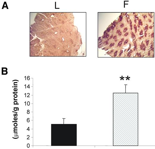 FIG. 1. Hepatic lipid accumulation in Lean and Fat mice. A: Oil red O staining of neutral lipid in Lean (L) (left panel) and Fat (F) (right panel) mice. Liver sections (30 μm) were stained as described in research design and methods. Magnification is 4×. B: Liver triglyceride levels in Lean and Fat mice. Livers were homogenized (1 ml/100 mg tissue) in isopropanol to extract triglycerides before measurement with a kit as described in research design and methods. Data are the means ± SE. **P < 0.01 for differences between lines. ▪, Lean mice; , Fat mice.