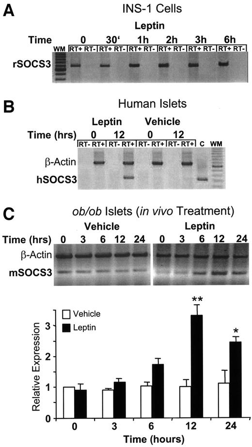 FIG. 5. Leptin induction of SOCS3 mRNA expression in INS-1 β-cells and human pancreatic islets in vitro and in islets of ob/ob mice in vivo. A: RT-PCR for rat SOCS3 (rSOCS3) mRNA in leptin (10 ng/ml)-treated INS-1 β-cells. RT−, reverse transcription reaction without reverse transcriptase (control for DNA contamination); WM, DNA weight marker. B: RT-PCR for human SOCS3 (hSOCS3) and β-actin mRNAs in leptin (10 ng/ml)-treated human pancreatic islets. C, positive control PCR using a plasmid harboring the 317-bp hSOCS3 PCR product as template. C: Semiquantitative RT-PCR for murine SOCS3 (mSOCS3) and β-actin mRNAs in pancreatic islets of ob/ob mice after in vivo injection with leptin at 1 μg/g body wt or vehicle (n = 4 per time point). Representative gel (top panel). Densitometric quantitation of SOCS3 PCR products normalized to β-actin expression from three independent experiments ± SE (lower panel). *P < 0.05; **P < 0.01.