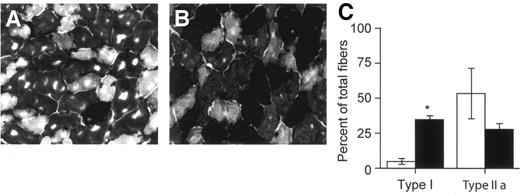 FIG. 2. Fiber typing in skeletal muscle. Gastrocnemius muscles obtained from wild-type (A) and MGSKO (B) mice were stained for ATPase. Under conditions of the staining, type I fibers stain black, type IIA fibers stain pale, type IIB fibers stain intermediate. Representative pictures are shown. C: quantitation of type I and type IIA fibers. □, wild type; ▪, MGSKO. *P = 0.0004 compared with wild type