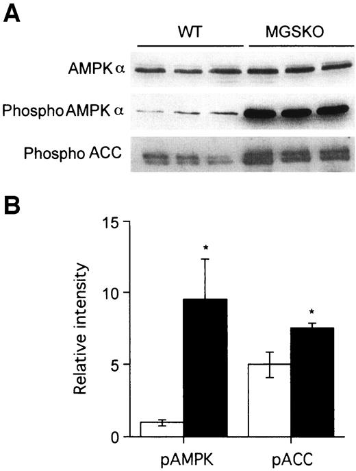 FIG. 3. Phosphorylation state of AMPK and ACC in skeletal muscle. A: Whole hindlimb muscle from wild-type (WT) and MGSKO animals was analyzed by Western blotting for total AMPK, phosphorylated AMPK (pAMPK), and phosphorylated ACC (for pACC). B: Densitometric quantitation of phosphorylated AMPK and ACC. Wild-type values were normalized such that their average equals one (for pAMPK) or five (for pACC). *P < 0.05 compared with wild type.