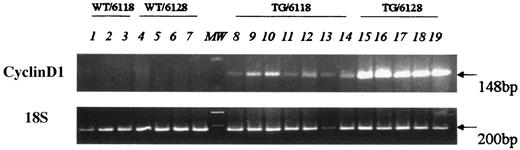 FIG. 2. RT-PCR for cyclin D1 transgene expression. One microgram of pancreatic RNA from wild-type and transgenic mice of the 6118 and 6128 strains was reverse transcribed and then amplified with PCR with specific primers for the human cyclin D1 transgene (40 cycles) and 18s RNA (35 cycles). Lanes 1–7, wild-type (WT) animals; lanes 8–19, transgenic (TG) animals. The mean ages of the 6118 and 6128 transgenic animals were 26.9 and 21.8 months, respectively. The mean ages of the wildtype 6118 and 6128 animals were 25.7 and 22.5 months, respectively.