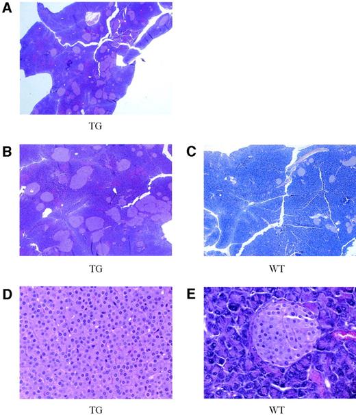 FIG. 3. H+E-stained sections of transgenic pancreata from the 6118 and 6128 lines. A: Low-power image reveals a marked increase in islet size and number in a representative transgenic male animal from the 6118 line. Higher power views of H+E-stained sections of pancreata from paired male animals from the 6128 line. TG, transgenic (B); WT, wild type (C); magnification = 20×. High power image of H+E-stained section of a transgenic islet from a 14-month-old animal (D) and age-matched wild-type animal (E); magnification = 500×.