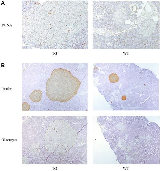 FIG. 4. A: Immunohistochemical staining for PCNA. Rare PCNA-positive cells are seen in islets from wild-type (WT) animals, but abundant PCNA-positive cells are detected in islets expressing the cyclin D1 transgene. All mice examined were males over 12 months in age. These are paired animals from the 6118 line. Magnification = 250×. B: Immunohistochemical staining for insulin and glucagon. Sequential sections were stained separately. Both the transgenic (TG) and wild-type mice were males from the 6128 line. The transgenic islet stains positively for insulin throughout. The distribution of glucagon-staining cells is somewhat altered in transgenic islets, and they are no longer located peripherally as in the wild-type islet. Magnification = 125×.
