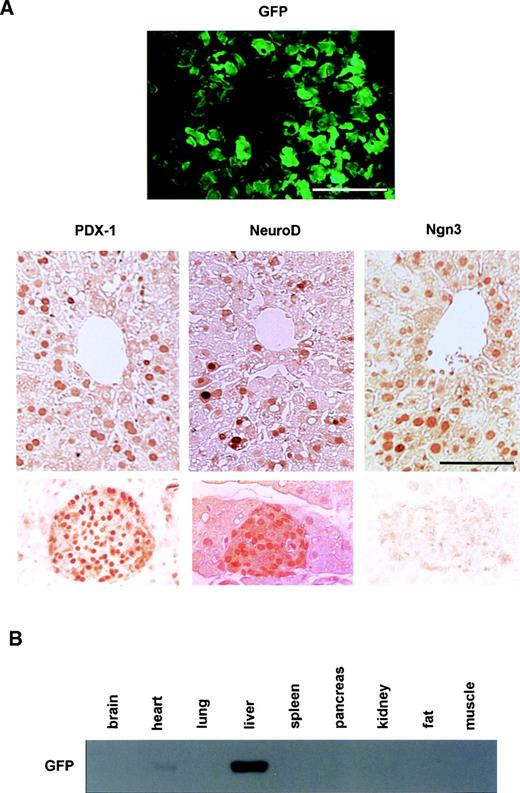 FIG. 1. Adenovirus-mediated expression of PDX-1, NeuroD, and Ngn3 in the liver. A: Male C57BL/6 mice were injected with Ad–PDX-1, Ad-NeuroD, Ad-Ngn3, or Ad-GFP (1 × 1010 PFU/ml) into the cervical vein. Each panel shows a representative liver after exposure to each adenovirus. As seen with GFP (upper panel), many cells in the liver were infected after exposure to Ad-GFP. PDX-1, NeuroD, or Ngn3 protein expression was also clearly detected in the liver after infection with Ad-PDX, Ad-NeuroD, or Ad-Ngn3 (middle panels). Bar, 50 μm. In addition, it is known that PDX-1 and NeuroD are expressed in mature pancreatic islets and that Ngn3 is transiently expressed at the embryonic stage during pancreas development. As expected, PDX-1 and NeuroD, but not Ngn3, were clearly detected in mouse mature pancreatic islets by immunostaining using the same antibodies (lower panels). B: Male C57BL/6 mice were injected with Ad-GFP into the cervical vein. We then obtained whole cell extracts from various tissues (brain, heart, lung, liver, spleen, pancreas, kidney, fat, and muscle) and performed Western blot analysis with anti-GFP antibody.