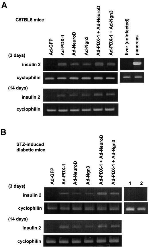 FIG. 2. Adenoviral expression of PDX-1, NeuroD, and Ngn3 in the liver induces insulin gene expression. A: Male C57BL/6 mice were injected with Ad–PDX-1, Ad-NeuroD, Ad-Ngn3, or Ad-GFP (1 × 1010 PFU/ml). Then, 3 (upper panel) and 14 (lower panel) days after the injection we examined insulin mRNA expression by RT-PCR. Insulin mRNA expression in the liver and pancreas without adenovirus treatment is also shown (right panel). B: Male C57BL/6 mice were made diabetic with STZ and injected with Ad–PDX-1, Ad-NeuroD, Ad-Ngn3, or Ad-GFP (1 × 1010 PFU/ml) 1 week later. Then 3 (upper panel) and 14 (lower panel) days after injection, we examined insulin mRNA expression by RT-PCR. Similar results were obtained in three independent experiments. Insulin mRNA expression in the liver (lane 1) and pancreas (lane 2) after STZ administration are also shown (right panel).