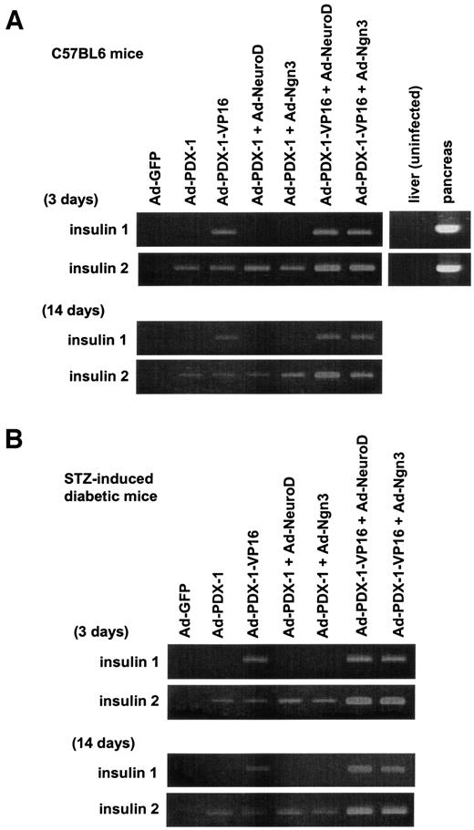 FIG. 5. Adenoviral expression of PDX-1/VP16 in the liver, together with NeuroD or Ngn3, induces insulin gene expression. A: Male C57BL/6 mice were injected with Ad–PDX-1, Ad-NeuroD, Ad-Ngn3, or Ad-GFP (1 × 1010 PFU/ml) into the cervical vein. Then, 3 (upper panel) and 14 (lower panel) days after the injection we examined insulin 1 and 2 mRNA expression by RT-PCR. Insulin mRNA expression in the liver and pancreas without the adenovirus treatment is also shown (right panel). B: Male C57BL/6 mice were made diabetic with STZ and 1 week later were injected with Ad–PDX-1/VP16, Ad-NeuroD, Ad-Ngn3, or Ad-GFP (1 × 1010 PFU/ml). Then 3 (upper panel) and 14 (lower panel) days after the injection, we examined insulin 1 and 2 mRNA expression by RT-PCR. Similar results were obtained in three independent experiments.