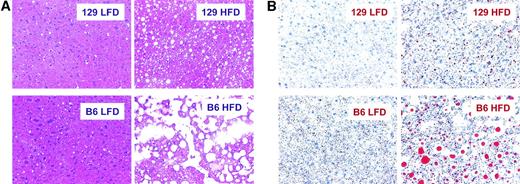 FIG. 2. High-fat feeding leads to steatosis. Livers were stained with hematoxylin and eosin (A) or Oil-Red-O (B). Representative sections are shown (original magnification ×200). Alternatively, hepatic lipids were extracted and triglyceride (C) and cholesterol ester (D) content was measured. *P ≤ 0.01 for strain effect; +P ≤ 0.01 for diet effect; #P ≤ 0.01 for their interaction. Double symbols indicate P ≤ 0.0001.