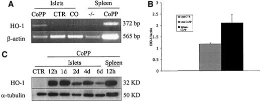 FIG. 1. HO-1 can be induced at the mRNA and the protein level in DBA/2 mice by a single 20-mg/kg injection of CoPP. A: RT-PCR. Samples were islets from CoPP-treated, nontreated (CTR), and CO-administered donors, and spleens from HO-1 knockout (negative control) and CoPP-injected (positive control) mice. B: The HO-1 expression in islets at the mRNA level was ∼50% as strong as that seen in spleen 12 h postinjection. C: HO-1 protein expression in islets was detected as early as 12 h after a single injection of CoPP and maintained above the control level for at least 6 days. Results are representative of three independent experiments. d, day.