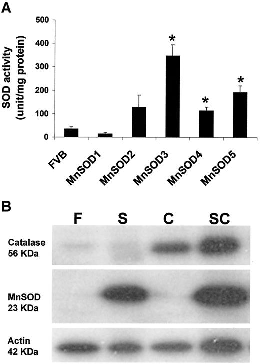 FIG. 1. SOD enzyme activity and protein expression of MnSOD and catalase in isolated islets from control and transgenic mice. A: Total islet SOD activity measured by inhibition of the auto-oxidation of pyrogallol, as described in research design and methods. Each bar represents the means ± SE of three to eight assays from three independent islet preparations. *P < 0.01 vs. FVB. B: Immunoblotting of MnSOD and catalase in isolated islets of FVB control (F), MnSOD3 (S), catalase (C), and MnSOD3 plus catalase (SC) mice. Whole-islet lysates (2 μg) were fractionated by SDS-PAGE and analyzed by Western blot using specific antibodies. One representative figure of three independent experiments with similar results is shown.