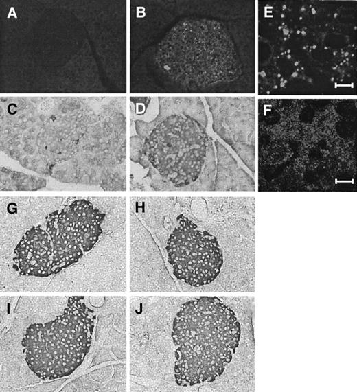 FIG. 2. MnSOD and catalase transgenes are specifically expressed in islets at high levels without influence on islet structure and insulin staining. A–F: Immunohistochemistry on pancreatic sections for MnSOD protein in FVB (A) and MnSOD (B) mice and for catalase expression in FVB (C) and catalase (D) mice. E and F: Confocal microscopy images for MnSOD (E) and catalase (F) immunostaining revealing the different subcellular distributions. MnSOD is excluded from nuclei with a punctate expression pattern consistent with a mitochondrial localization. Catalase staining is also excluded from nuclei but with a much more diffuse distribution. G–J: Insulin immunostaining in control FVB (G) and transgenic MnSOD (H), catalase (I), and MnSOD plus catalase (J) mice. Original magnification ×400. Scale bars, 5 μm.