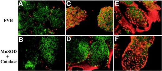 FIG. 9. Cytokine- and H2O2-induced NF-κB activation. FVB control (top row) and MnSOD plus catalase transgenic islets (bottom row) were left untreated (A and B), treated with 50 μmol/l H2O2 (C and D), or treated with cytokines (10 units/ml IL-1β plus 100 units/ml IFN-γ; E and F) for 2 h. Islet frozen sections were immunostained with rabbit anti–NF-κB (p50) antibody and visualized with Cy3-conjugated anti-rabbit IgG. When NF-κB is activated and translocates, nuclei become visible as bright red spots. C and E: H2O2 and cytokines activate NF-κB in FVB control islets. MnSOD and catalase block NF-κB activation by H2O2 (D), whereas the antioxidants do not block activation by cytokines (F). Cy3 staining outside of the islet is due to residual mounting material. Original magification ×400. Results were replicated in three independent experiments for H2O2 and four independent experiments for cytokines.