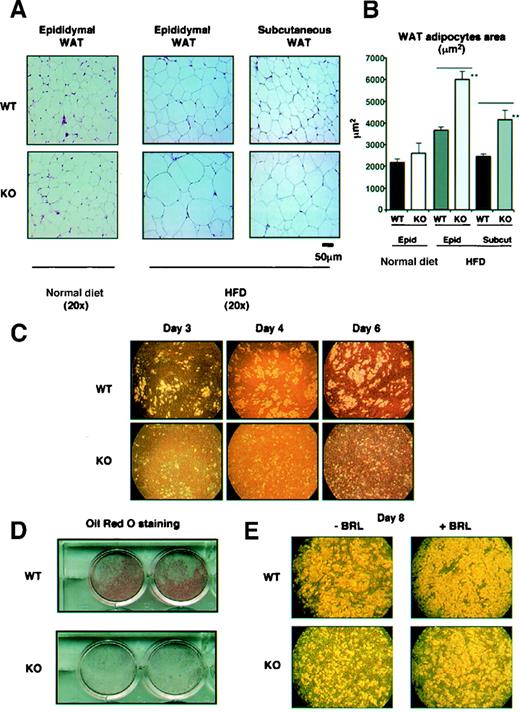 FIG. 3. Characterization of the WAT of PPARγ2 knockout mice. A: Representative histological appearance of hematoxylin-eosin–stained sections from epididymal WAT, from male wild-type and PPARγ2 knockout mice fed a normal diet (n = 7), and from epididymal and subcutaneous WAT depots from mice fed a 16-week HFD (n = 5). B: Area of epididymal and subcutaneous WAT adipocytes (200 random adipocytes) from wild-type and PPARγ2 knockout mice fed a normal diet and an HFD (n = 5). **P < 0.01 (Kruskal-Wallis test). C: Time course of WAT preadipocyte differentiation from wild-type and PPARγ2 knockout mice. Cells were observed by light microscopy after 3, 4, and 6 days of differentiation with standard differentiation-induction medium (representative experiment of three). D: Oil Red O staining of WAT adipocytes after 8 days of differentiation from wild-type and PPARγ2 knockout mice. E: 8 days of differentiation of WAT preadipocytes from wild-type and PPARγ2 knockout mice with and without BRL treatment.