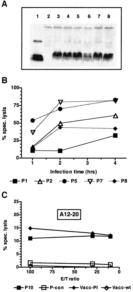 FIG. 4. Natural processing of proinsulin epitopes. A: HeLaS3 cells were infected with different isolates of a recombinant vaccinia virus encoding human preproinsulin (lanes 3–8) or a virus encoding IA-2 (lane 2) and tested for proinsulin expression by Western blot analysis using an antiserum against insulin. Lane 1 contains 1 μg of recombinant proinsulin. B: HHD-transfected HeLa cells were infected with vaccinia/preproinsulin for the indicated periods, labeled with 51Cr, and incubated with CTLs at an effector-to-target ratio of 100. Lysis of cells infected with wild-type vaccinia was <2% for all CTL lines. Shown is one of three similar experiments. C: Specific killing of HeLa-HHD cells pulsed with 1 μmol/l peptide A12-20 (P10) or a control peptide (P-con; GILGFVFTL) or infected with vaccinia proinsulin (Vacc-PI) or wild-type vaccinia (Vacc-wt) at different effector-to-target ratios. Note the different scale of this panel relative to panel B.