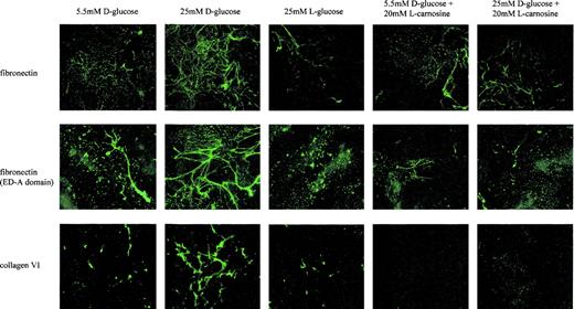 FIG. 2. Human thermosensitive SV 40–transformed podocytes were cultured at nonpermissive conditions (37°C) under various concentrations of d-glucose in the presence or absence of 20 mmol/l l-carnosine. A total of 25 mmol/l l-glucose was used as osmotic control. After 14 days, indirect immunofluorescence stainings were performed. The figure shows an increased production of fibronectin and collagen type VI in podocytes cultured with 25 mmol/l glucose compared with normal glucose (5.5 mmol/l). The panels on the right show that carnosine inhibits this increase.