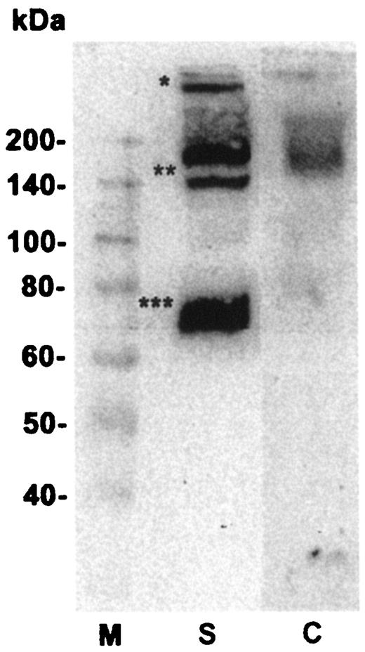 FIG. 1. Adiponectin oligomers under nonreducing and nonheat-denaturing conditions. Specificity of reaction is shown by competition (M, marker; S, sample; C, competition). Specific adiponectin oligomers were found at ∼70 kDa (***), which represents the LMW trimer, two bands at ∼140 and ∼180 kDa (**), which represent the MMW hexamers, and the HMW complex at >300 kDa (*), as described previously (23).