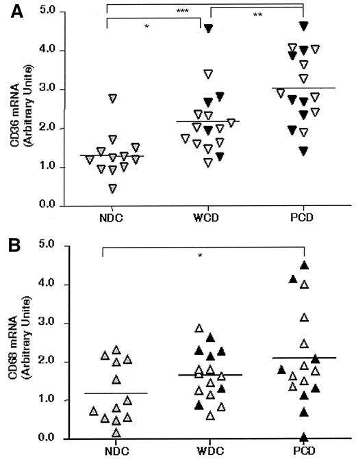 FIG. 2. CD36 and CD68 mRNA expression. Expression of CD36 mRNA (A) and expression of CD68 mRNA (B) in CD14+ monocytes from control subjects (NDC), well-controlled diabetic patients (WCD), and poorly controlled diabetic patients (PCD). ▵, patients with type 2 diabetes; ▴, patients with type 1 diabetes; and , control subjects. The mRNA level was quantified using real-time RT-PCR; n = 12 (NDC), n = 16 (WCD), n = 16 (PCD). *P < 0.05; ***P < 0.005; ***P < 0.0005.