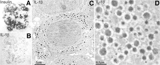 FIG. 3. High-glucose–induced expression of IL-1β by human β-cells. Cultured human islets were exposed for 4 days to media containing 5.5 (not shown) or 33.3 mmol/l glucose and gold-immunolabeled for insulin (A) or IL-1β (B–D) as previously described (19,20). Light microscopy of consecutive semi-thin sections of a human islet showing the high degree of coexistence of insulin (A) and IL-1β (B) is shown, as is electron microscopy of an ultra-thin section of a β-cell (C and D). At higher magnification, immunogold-labeled IL-1β (dense spherical particles) can be localized to the secretory granules as characterized by a dense core (D). Samples were prepared and evaluated by two investigators (E.E. and M.R.) blinded to the treatment conditions. IL-1β was detected only in β-cells exposed to high glucose.
