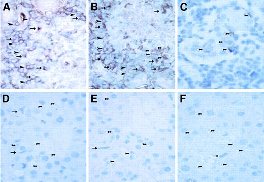 FIG. 4. Morphology of an islet from a diabetic IDDM (LEW.1AR1/Ztm-iddm) rat (A–C) exhibiting hyperglycemia (21.4 mmol/l) and hypoinsulinemia (0.5 ng/ml) 1 day after diabetes manifestation and of an islet from a type 2 diabetes Psammomys obesus (sand rat) (D–F) exhibiting hyperglycemia (17.5 mmol/l) and hyperinsulinemia (1.8 ng/ml) after 3 weeks on a high-energy diet. The sections were immunostained for IL-1β (A and D), iNOS (B and E), and activated caspase-3 (C and F) and show cytoplasmic immunoreactivities only in the infiltrated islets of the type 1 diabetic animal (A–C). Infiltrating immune cells in the diabetic IDDM rat (A–C) are mostly ED1+ macrophages (arrows) and CD8+ T-cells (arrowheads). These cells express immunoreactivity for IL-1β (A) and iNOS (B) but not for activated caspase-3 (C). Pancreatic β-cells undergoing apoptosis (thick arrows), in contrast, express immunoreactivity for iNOS and activated caspase-3, but not for IL-1β. The few infiltrating immune cells in the islet of a diabetic Psammomys obesus (D–F) are exclusively ED1+ macrophages (arrows). These cells show no signs of immunoreactivity for IL-1β (D), iNOS (E), or activated caspase-3 (F). β-Cells (thick arrows) of Psammomys showed signs of necrotic destruction including intra- and intercellular vacuolization without expression of IL-1β (D), iNOS (E), or activated caspase-3 (F). These β-cells showed no signs of nuclear heterochromatin condensation. The same findings were made after 1 week of a high-energy diet. ED1+ macrophages, CD8+ T-cells, and pancreatic β-cells were identified by sequential sections immunostained with specific antibodies against the given cell type as previously described (67,86) (data not shown). Original magnification ×400.