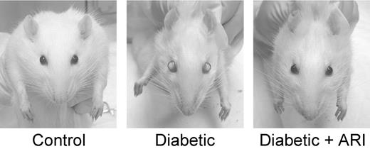 FIG. 2. Effect of ARI-809 on cataracts in rats with 4-months’ duration of diabetes. Drug treatment was initiated after 1 month of diabetes and continued for 3 months. No cataracts were detected in treated diabetic rats.
