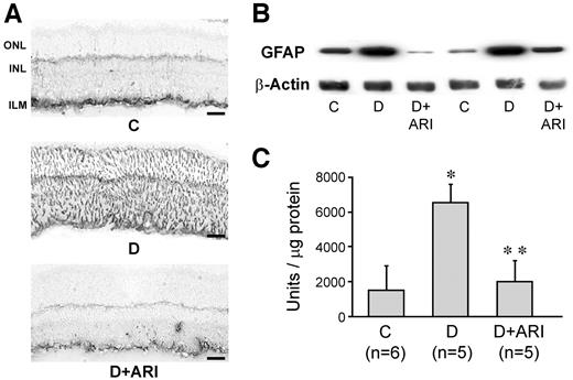 FIG. 4. Effect of ARI-809 on GFAP upregulation in the retina of diabetic rats. A: GFAP immunostaining in retinal sections shows in a diabetic rat the presence of GFAP throughout the length of the Müller cell process that span the retina but only in the glia of the inner retina in a diabetic rat treated with ARI-809. Bar = 50 μm. B: Representative immunoblot of retinal GFAP and β-actin. C: Quantitation of the signals from immunoblots of retinal GFAP. Bars represent the means ± SD. GFAP expression was completely corrected in the treated diabetic rats. *P = 0.0001 vs. control rats; **P = 0.0001 vs. untreated diabetic rats. C, control rats; D, diabetic rats; D+ARI, diabetic rats treated with ARI-809; ILM, inner limiting membrane; INL, inner nuclear layer; ONL, outer nuclear layer.