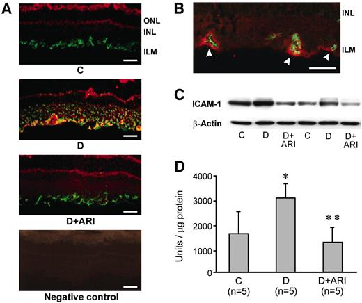 FIG. 5. Effect of ARI-809 on ICAM-1 upregulation in the retina of diabetic rats. A: Immunostaining for ICAM-1 (red) and GFAP (green) in retinal sections shows in a control rat GFAP staining only. In a diabetic rat, ICAM-1 is visible along the inner limiting membrane and in the wall of a large vessel; ICAM-1 staining is absent in a diabetic rat treated with ARI-809. Bar = 50 μm. B: Immunostaining for ICAM-1 (red) and von Willebrand factor (green, to identify vascular endothelial cells) in the retinal section of a diabetic rat shows that ICAM-1 is peripheral to the endothelium. Bar = 50 μm. C: Representative immunoblot of retinal ICAM-1 and β-actin. D: Quantitation of the signals from immunoblots of retinal ICAM-1. Bars represent the means ± SD. *P = 0.004 vs. control rats; **P = 0.0005 vs. untreated diabetic rats. ICAM-1 expression was completely corrected in the treated diabetic rats. C, control rats; D, diabetic rats; D+ARI, diabetic rats treated with ARI-809; ILM, inner limiting membrane; INL, inner nuclear layer; ONL, outer nuclear layer.